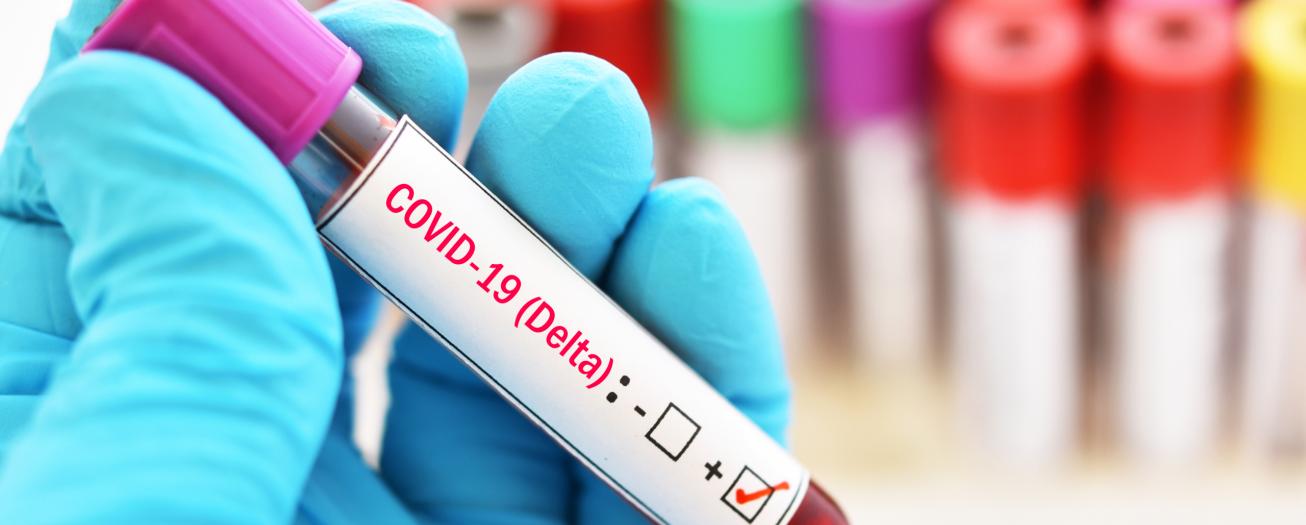 Casos y fallecimientos COVID-19 semanales aumentaron en más de 20%