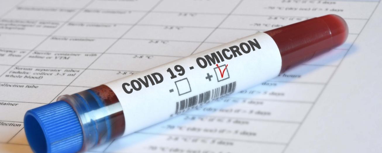 Casos, hospitalizaciones y fallecimientos COVID-19 continúan registrando alzas