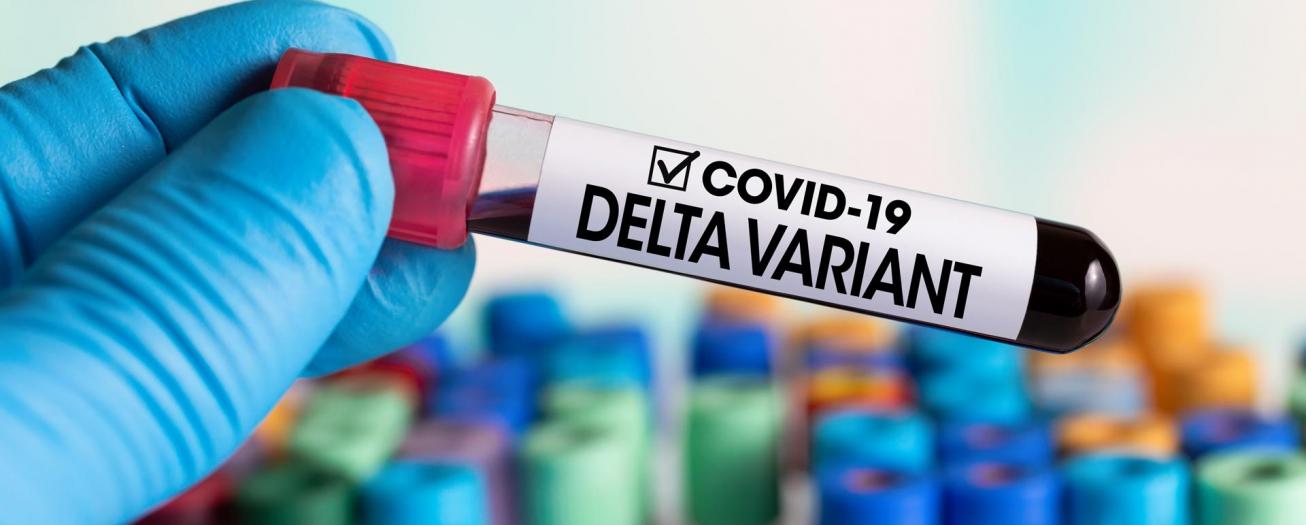 Variante Delta de la Covid-19 ya se registra en Grecia
